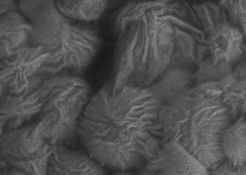 Alge Electron Micrograph