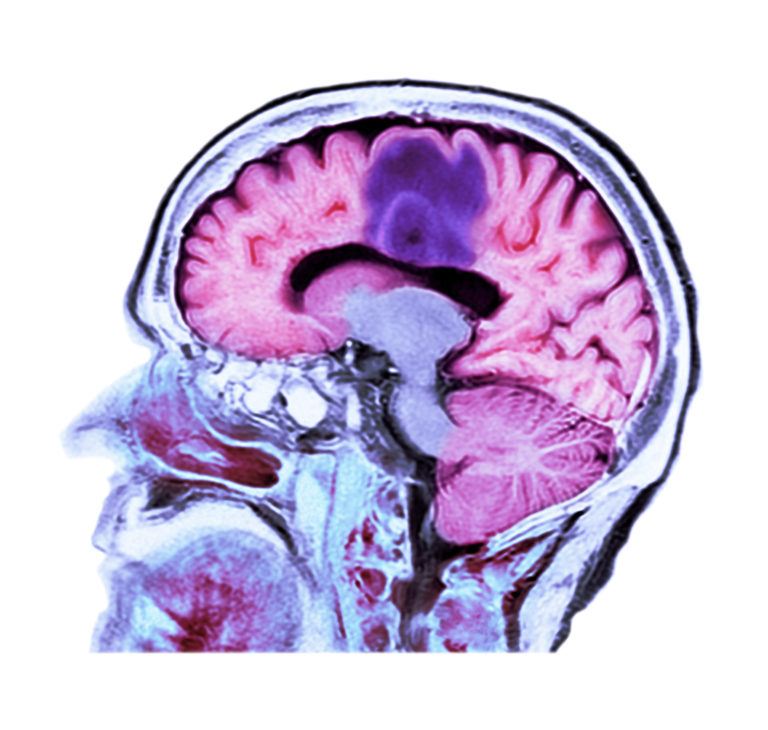 human head scan image